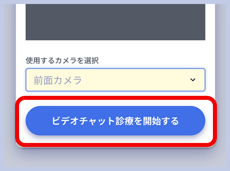 レバクリのビデオチャット診療画面。カメラ映像の確認とカメラの選択、「ビデオチャット診療を開始する」ボタンが表示されている。