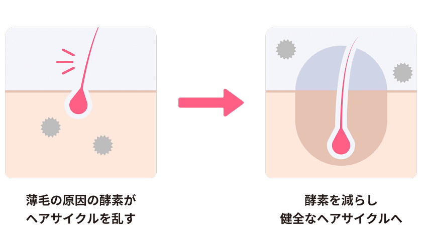 抜け毛予防
