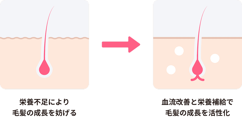 発毛促進