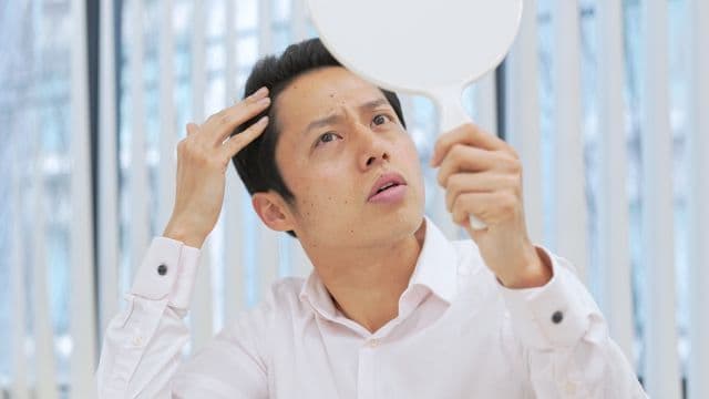 おでこが広いとハゲる？おでこハゲとの違いと原因と判断基準