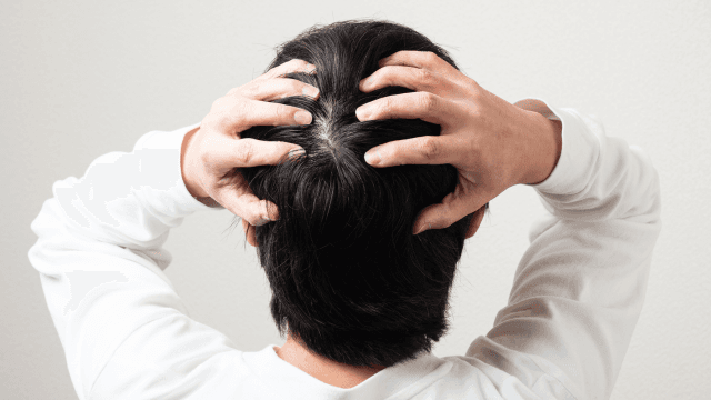 つむじハゲとは？主な原因や5つの対策を解説