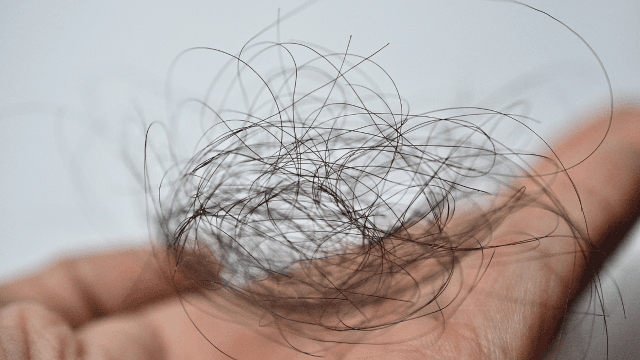 ミノキシジルをやめるとAGAは悪化する？再発のリスクややめた後の治療法を紹介