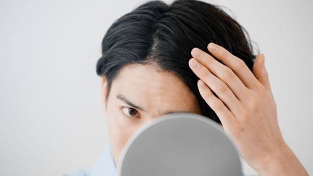 白髪とAGAの関係は？薄毛治療中の白髪の原因と対策