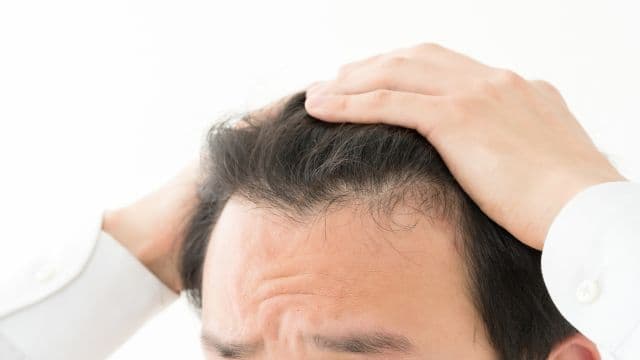 男性ホルモンが多いとはげるって本当？薄毛の原因と5つの対策を紹介