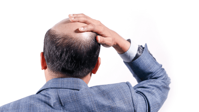 5αリダクターゼとは？AGAとの関係や抑制する方法を解説