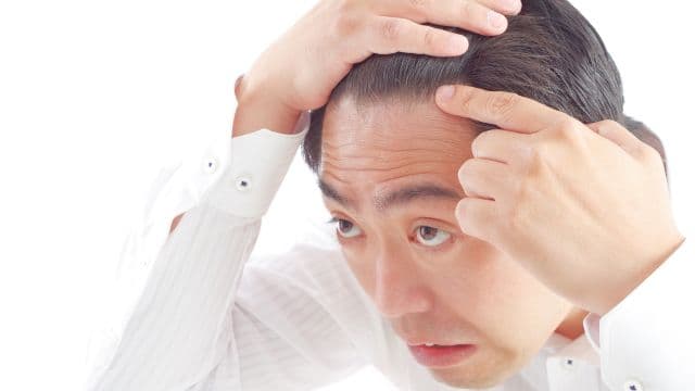 生え際がスカスカ…原因は？セルフチェック方法や対策を解説