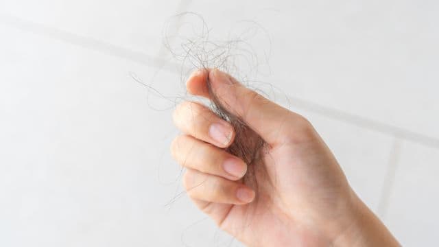 休止期脱毛症とは？種類や発症の原因、治療方法を解説