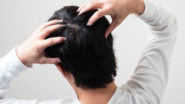 糖尿病と抜け毛の関係とは？薄毛になる理由や対処法を解説