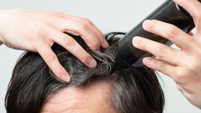 ミノキシジルのジェネリックとは？先発医薬品との違いや入手方法を解説