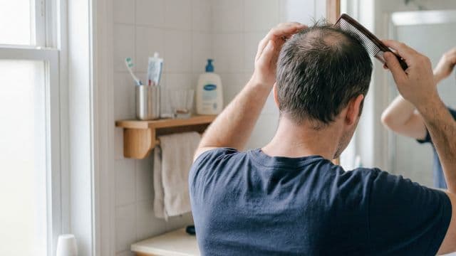 ミノキシジルは頭頂部の薄毛にも効く？塗り方や効かない場合の対策を解説