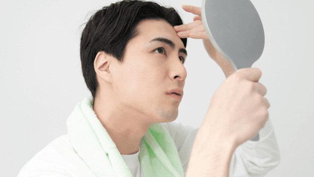 髪の毛の分け目が薄い悩みを改善！原因と対策方法を紹介