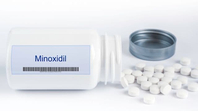 ミノキシジルだけでAGAは治る？外用薬だけでは不十分な理由や内服薬との併用について解説