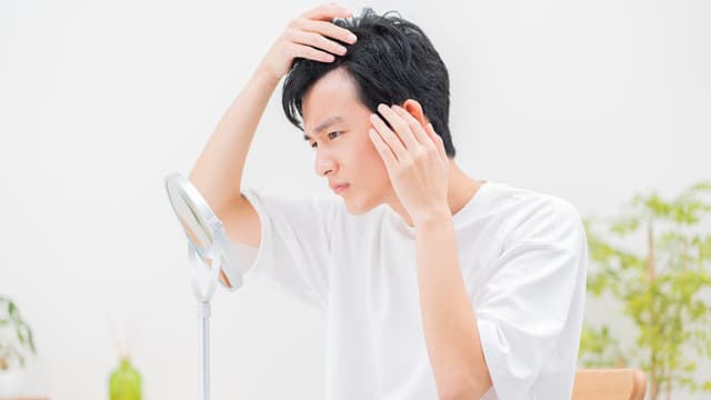 30代男性の薄毛の原因とAGA治療法を解説