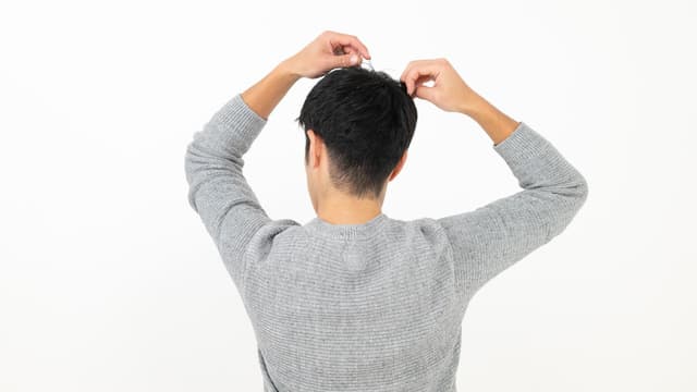 AGA治療は手遅れ？間に合う基準と進行度別の対処法