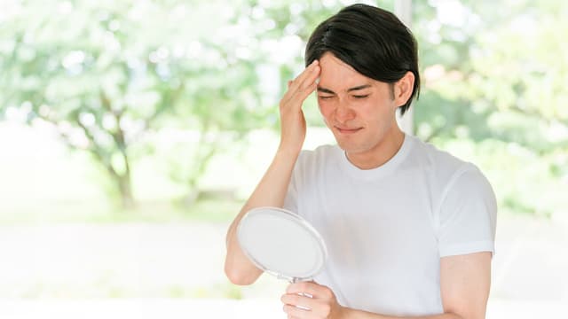 AGA治療は何歳から？20代の若ハゲ治療と年代別の始めどき