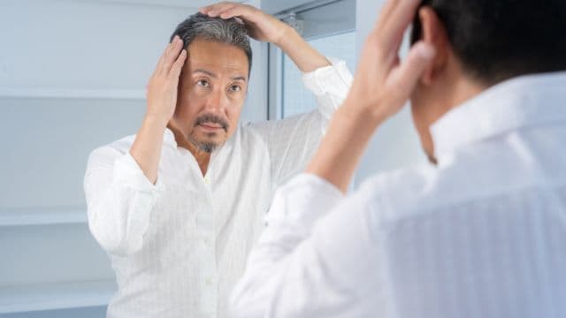 50代・60代の育毛で薄毛をケアする方法と治療の選択肢