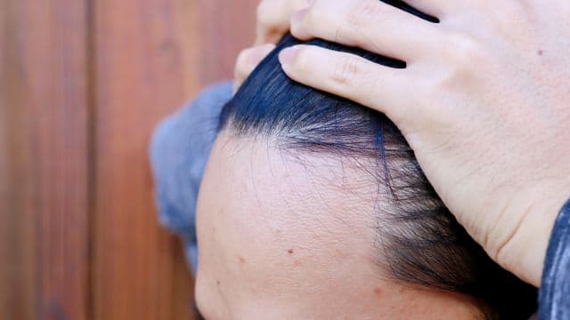 AGA治療薬フィナステリドの副作用は？効果や服用方法、注意点も解説