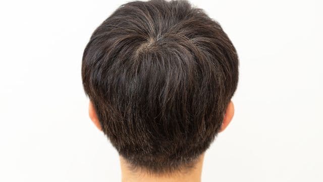 つむじが割れる原因と直し方は？薄毛・はげとの違いも解説