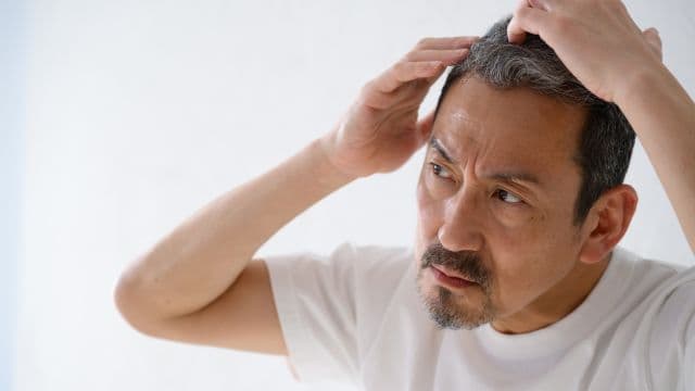 AGA治療薬の副作用にはなにがある？薬別の注意点や対処法を解説