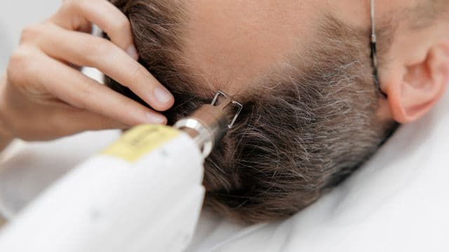 AGAのレーザー治療・LED光治療とは？効果・費用や承認薬との違いを解説