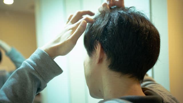 壮年性脱毛症とは？AGAとの違いや原因、治療法を解説