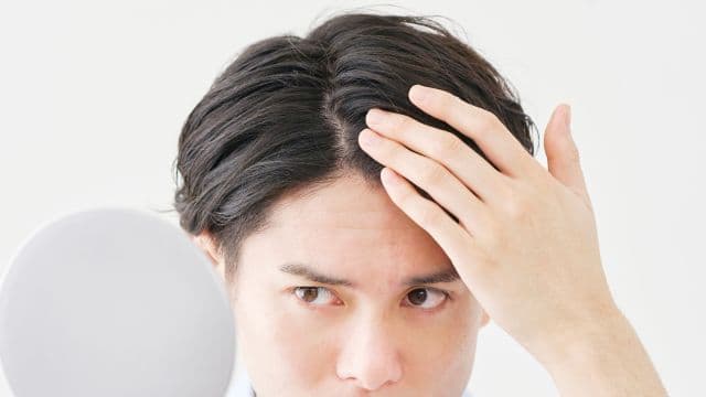 分け目はげとは？髪の毛の分け目が薄毛になる原因と対策方法を解説