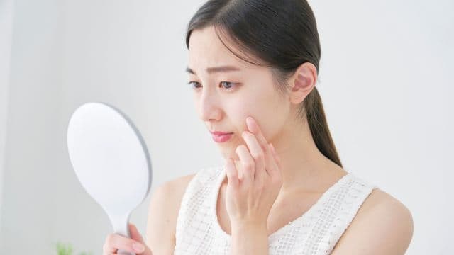生理前にニキビはできやすい？原因や対策、改善方法などを詳しく解説