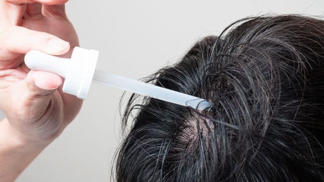 ミノキシジルとは？AGA治療の効果や外用薬の副作用について解説