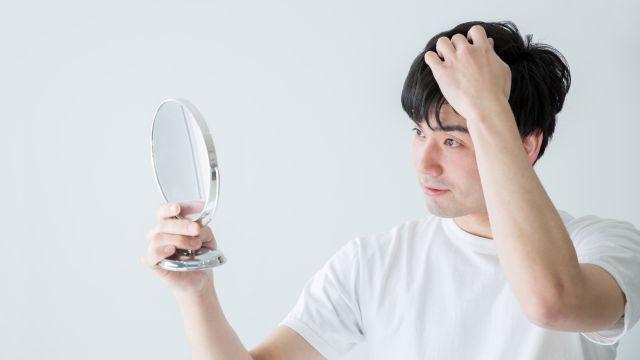 脂漏性脱毛症とは？症状の特徴や治し方、改善方法を解説
