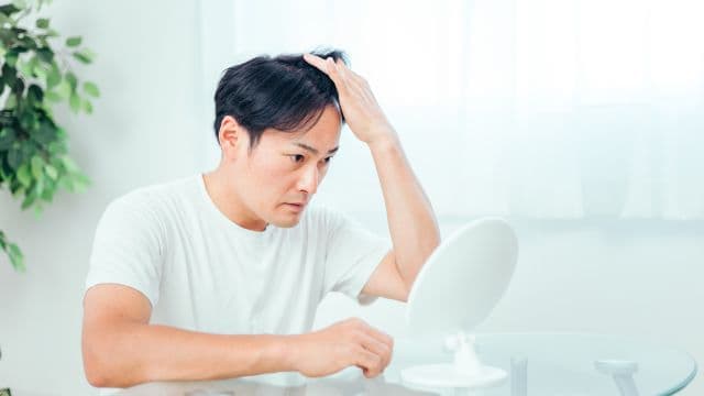 円形脱毛症後に白髪が生えるのはなぜ？原因と白髪を改善する方法を解説