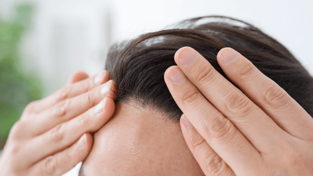 紫外線が頭皮や髪に与える影響とは？薄毛予防につながる紫外線対策も解説
