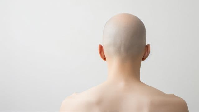 薄毛はスキンヘッドで隠せる？メリット・デメリットや似合う人の特徴を解説