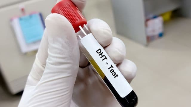 ジヒドロテストステロンとは？抑制する3つの方法も紹介