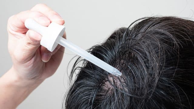 育毛剤と発毛剤の違いは？成分や効果、副作用の比較や向いている人を解説