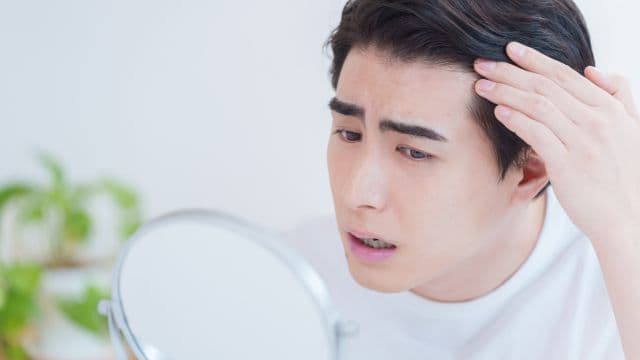 【男性編】前髪はげの基準や原因は？前髪が薄い場合の対策も解説