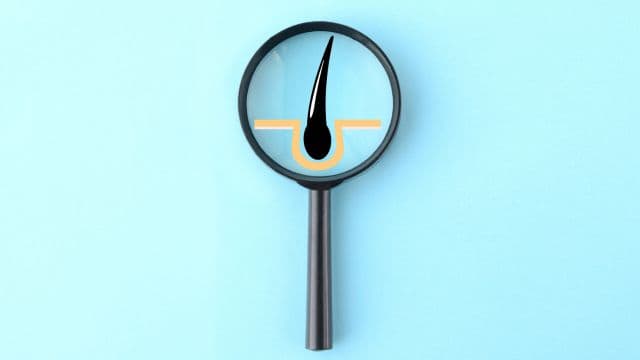 AGAが完治した人はいる？進行を食い止める治療法と注意点を解説