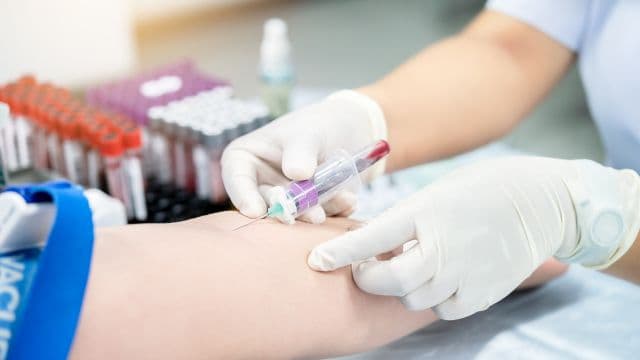 AGA治療に血液検査が必要な理由は？分かることや費用を解説