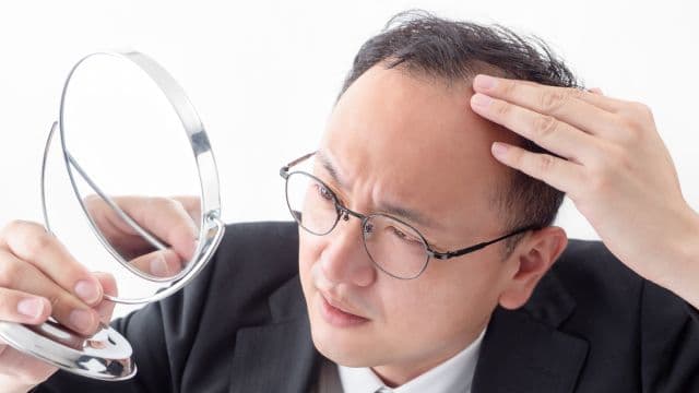 AGAと男性ホルモンの関係は？AGAの原因と対策5選