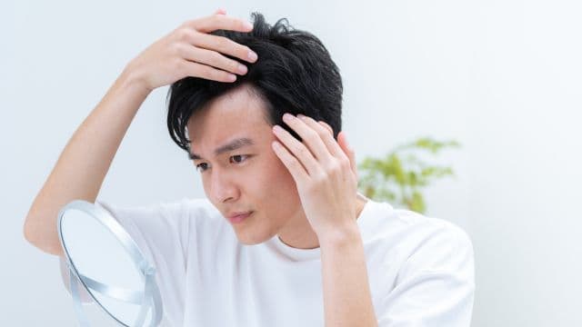 M字はげを治すにはどうすればいい？治療法や原因、セルフケアを紹介