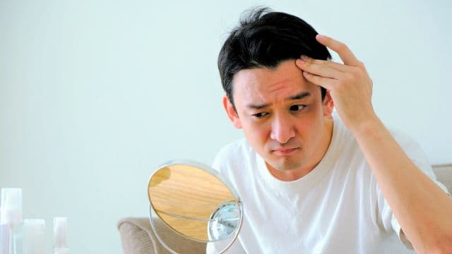 おでこの広さが指4本分だと薄毛の証拠?後天的に薄毛になる原因と改善方法