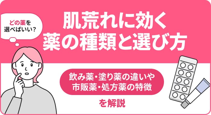 肌荒れに効く薬の種類と選び方:飲み薬・塗り薬の違いや市販薬・処方薬の特徴