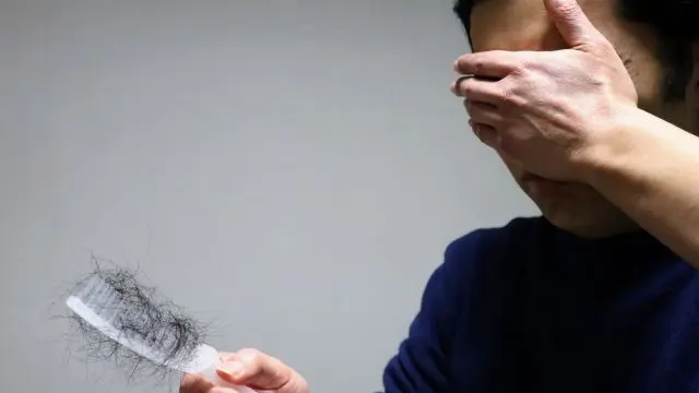 禿げやすい人の特徴7選|薄毛の前兆チェックと今すぐできる対策を解説