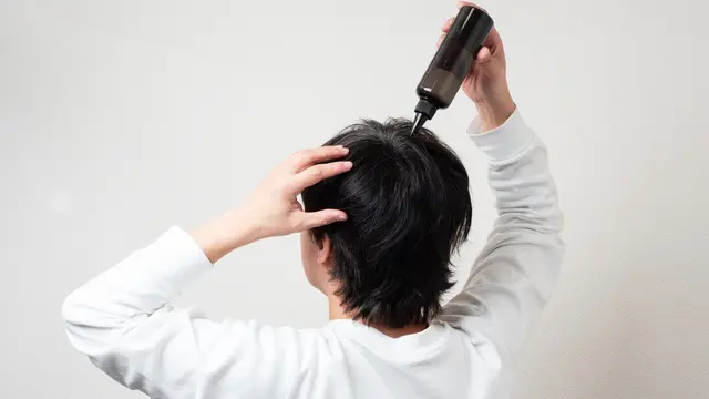 デュタステリド外用薬とは?副作用やAGA治療薬の選択肢を解説