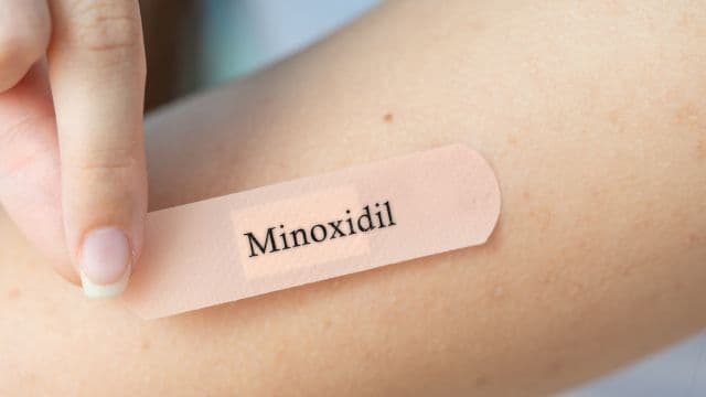 ミノキシジルの初期脱毛が起こる理由とは?原因と対策を解説