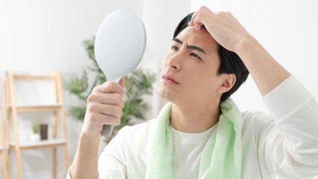 円形脱毛症は繰り返す？再発する原因と治療方法、予防について解説