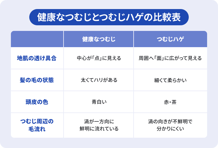 健康なつむじとつむじハゲを比較するための表。地肌の透け具合、髪の毛の状態、頭皮の色、つむじ周辺の毛流れを比較。