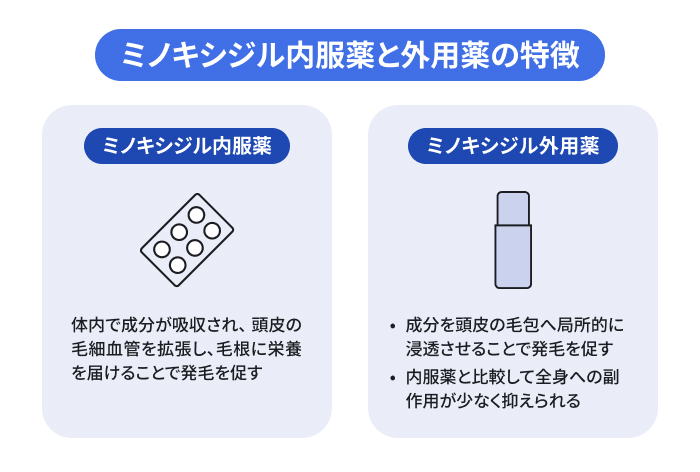 ミノキシジルの内服薬と外用薬の特徴を示したイラスト。ミノキシジル内服薬:体内から頭皮へアプローチする・ミノキシジル外用薬:薄毛が進行している部位へ直接塗る