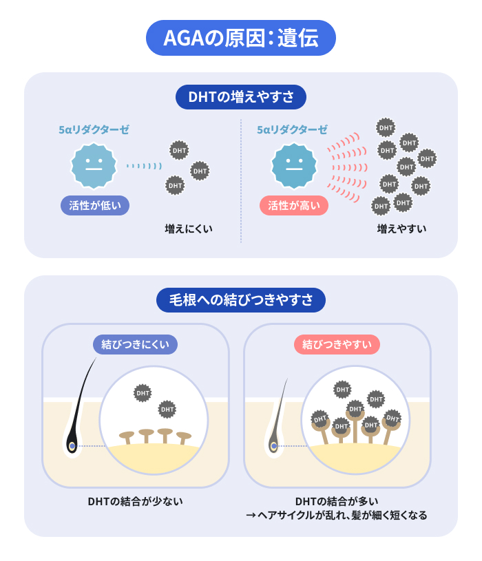 AGAの原因として、遺伝によって薄毛の原因の増えやすさ・毛根への結びつきやすさが決まることを説明したイラスト。