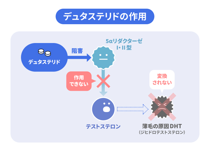 デュタステリドの作用を示したイラスト。デュタステリドによって5αリダクターゼI・II型が阻害されることで、DHT(ジヒドロテストステロン)の生成を抑制するメカニズムを説明。