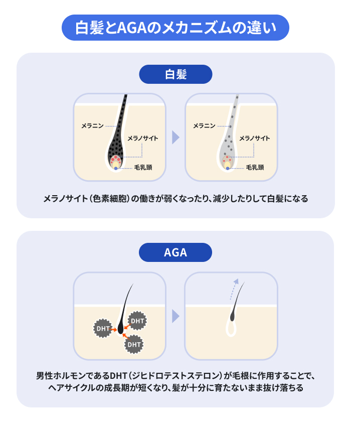 白髪はメラノサイトの機能低下によるメラニン減少で起こる現象。一方AGAは、男性ホルモンDHTが毛根に作用し、ヘアサイクルの成長期を短縮させることで細く短い髪のまま抜けてしまうという、両者の発生メカニズムの違いを比較。